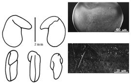  Cotyledon, embryo, and testa:  P. cajanifolia  (C.E.O. Kuntze) R.M. Polhill - embryo, cotyledons, and testa SEMs.
