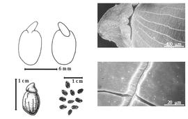  Seed, cotyledon, embryo, and testa:  P. cassioides  (F.J.H. von Mueller) Symon - bottom left fruit;  P. labicheoides  R. Brown - top seeds in situ, bottom right fruit.
