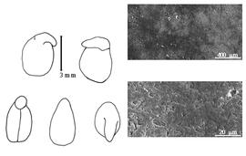  Cotyledon, embryo, and testa:  P. thompsoniae  S. Watson - embryo, cotyledons, and testa SEMs.
