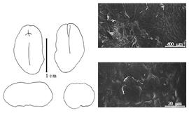  Cotyledon, embryo, and testa:  P. xylophylloides  (J.G. Baker) D.J. Du Puy, J.-N. Labat & B.D. Schrire - embryo, cotyledons, and testa SEMs.
