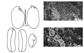  Cotyledon, embryo, and testa:  P. venenosum  J.H. Balfour - embryo, cotyledons, and testa SEMs.
