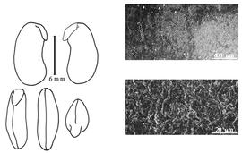  Cotyledon, embryo, and testa:  P. mollis  J.N. Rose - embryo, cotyledons, and testa SEMs.
