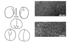  Cotyledon, embryo, and testa:  P. sativum  C. Linnaeus subsp.  elatius  (C. von Steven ex F.A.M. von Bieberstein) P.F.A. Ascherson & K.O.R.P.P. Graebner - embryo, cotyledons, and testa SEMs.
