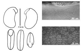  Cotyledon, embryo, and testa:  P. andongense  (F.M.J. Welwitsch ex J.G. Baker) L.L. Hauman - embryo, cotyledons, and testa SEMs.
