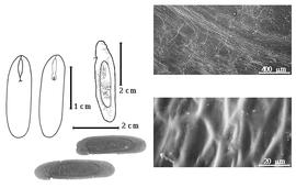  Seed, cotyledon, embryo, and testa:  P. psilostachya  (G. Bentham) G.P. Lewis & M.P. Lima - left cotyledon not concealing radicle (L) and embryonic axis (R), left top center seed topography, left bottom center seeds, testa SEMs.
