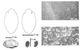  Seed, cotyledon, embryo, and testa:  P. palustris  C.F. Symington - top left cotyledon split and gaping and concealing radicle (L) and embryonic axis (R), bottom far left seed topography, bottom left center seeds, testa SEMs.
