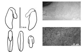  Cotyledon, embryo, and testa:  P. obcordata  (R. Brown) G. Bentham - embryo, cotyledons, and testa SEMs.
