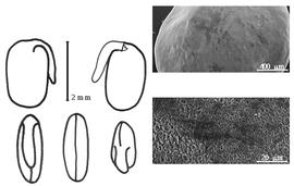  Cotyledon, embryo, and testa:  R. sphaerosperma  A.P. de Candolle - embryo, cotyledons, and testa SEMs.
