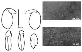  Cotyledon, embryo, and testa:  R. pseudoacacia  C. Linnaeus - embryo, cotyledons, and testa SEMs.
