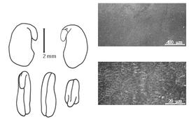 Cotyledon, embryo, and testa:  R. physodes  (D. Douglas ex W.J. Hooker) J.W. Grimes - embryo, cotyledons, and testa SEMs.
