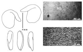  Cotyledon, embryo, and testa:  S. wardii  E.G. Baker - embryo, cotyledons, and testa SEMs.
