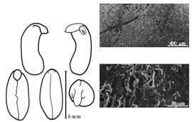  Cotyledon, embryo, and testa:  S. binnendyckianum  (W.S. Kurz) R. Geesink - embryo, cotyledons, and testa SEMs.
