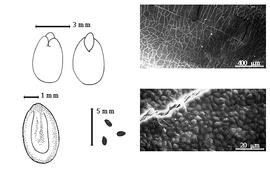  Seed, cotyledon, embryo, and testa:  S. novoguineensis  (O. Warburg) Verdcourt - top left cotyledons concealing all but radicle tip (L) and embryonic axis (R), bottom left seed topography, testa SEMs;  S.  spp. - bottom left center seeds.
