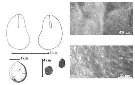  Seed, cotyledon, embryo, and testa:  S. zenkeri  H.A.T. Harms - top left cotyledon with long split and concealing radicle (L) and embryonic axis (R), bottom far left seed topography, bottom left center seeds, testa SEMs.
