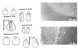  Cotyledon, embryo, and testa:  S. alata  (C. Linnaeus) W. Roxburgh - 1st row center embryo in situ in endosperm, 2nd row top cotyledons cordate with radicle exposed or nearly so;  S. alexandrina  (Thullier) Irwin & R.C. Barneby - 1st row top cotyledons cordate with radicle exposed or nearly so;  S. artemisioides  (Gaudichaud-Beaupre) Irwin & R.C. Barneby - 2nd row bottom 2 views of triple embryos;  S. multijuga  (L.C. Richard) Irwin & R.C. Barneby - 2nd row center cotyledons cordate with radicle exposed or nearly so;  S. occidentalis  (C. Linnaeus) Irwin & R.C. Barneby - testa SEMs;  S. siamea  (J.B.A.P. de M. de Lamarck) Irwin & R.C. Barneby - 1st row bottom cotyledons cordate with radicle exposed or nearly so.
