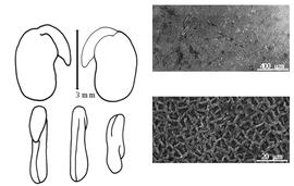  Cotyledon, embryo, and testa:  S. turkestana  A.A. von Bunge - embryo, cotyledons, and testa SEMs.
