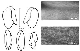  Cotyledon, embryo, and testa:  S. junceum  C. Linnaeus - embryo, cotyledons, and testa SEMs.
