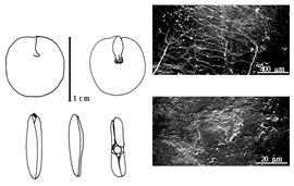  Cotyledon, embryo, and testa:  S. acatlensis  (G. Bentham) R.C. Barneby & J.W. Grimes - embryo, cotyledons, and testa SEMs.
