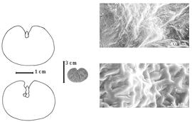  Seed, cotyledon, embryo, and testa:  S. monosperma  (E.L.R. Tulasne) I. Urban - left cotyledon notched and investing exposed radicle (above) and embryonic axis (below), left center seed, testa SEMs
