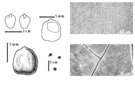  Seed, cotyledon, embryo, and testa:  S. pancheri  Vieillard - top far left cotyledon cordate and investing exposed radicle (L) and embryonic axis (R), top left center translucent endosperm with embryo in situ, bottom far left seed topography, bottom left center seeds, testa SEMs.
