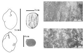  Seed, cotyledon, embryo, and testa:  S. borneensis  O. Stapf - far left cotyledon split and groined and concealing radicle (above) and embryonic axis (below), top left center seed topography, bottom left center seed, testa SEMs.
