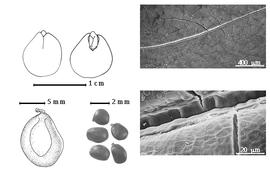  Seed, cotyledon, embryo, and testa:  T. tetraptera  (Schumacher & Thonning) P.H.W. Taubert - top left cotyledon concealing all but tip of radicle (L) and embryonic axis (R), bottom left seed topography, bottom center seeds, and testa SEMs.
