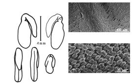  Cotyledon, embryo, and testa:  T. foenum-graecum  C. Linnaeus - embryo, cotyledons, and testa SEMs.
