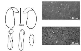  Cotyledon, embryo, and testa:  V. oroboides  (B. Bergius) T.M. Salter - embryo, cotyledons, and testa SEMs.
