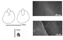  Seed, cotyledon, embryo, and testa:  X. viridiramis  (Burchell) P.H.W. Taubert - top left cotyledon not concealing radicle (L) and embryonic axis (R), bottom left seed, testa SEMs.
