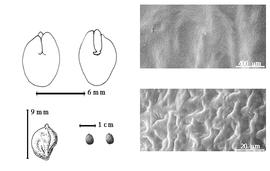  Seed, cotyledon, embryo, and testa:  Z. punctata  J.A. Cavanilles - top left cotyledon split and basally groined and concealing all but tip of radicle (L) and embryonic axis (R), bottom far left seed topography, bottom left center seeds, testa SEMs.
