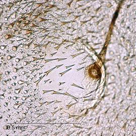  Chloridea virescens , microspines. Photo courtesy of Todd Gilligan and Steven Passoa. 
 