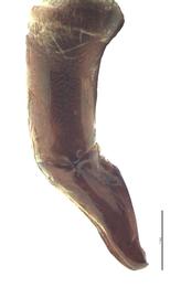   Onitis vanderkelleni  male genitalia, lateral view; photo by E.L. Engasser 