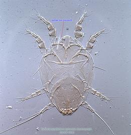  Fig. 1.  Tortonia quadridens  phoretic deutonymph, dorsal view. 