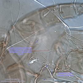  Fig. 10.  Acarus siro  female propodosoma, dorso-lateral view. 