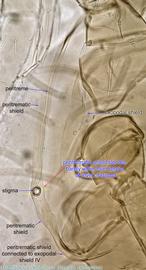  Fig. 10.  Blattisocius dentriticus  female peritreme. 