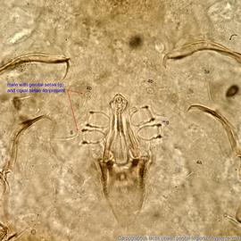  Fig. 10.  Carpoglyphus lactis  male anterior hysterosoma, ventral view. 