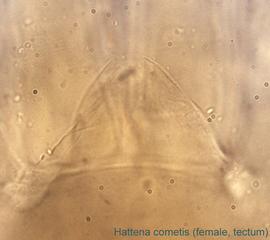  Fig. 10.  Hattena cometis  female anterodorsal gnathosoma showing tectum. 