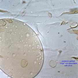  Fig. 10.  Histiostoma feroniarum  female ventral region showing genital 'rings.' 