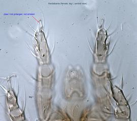  Fig. 10.  Kerdabania  female leg I, ventral view. 