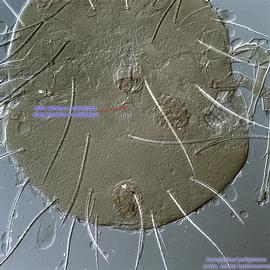  Fig. 11.  Aeroglyphus peregrinans  male hysterosoma, ventral view. 