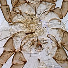  Fig. 11.  Horstiella  sp. (ex  Epicharis rustica , Trinidad and Tobago) male, optical section showing gut contents. 