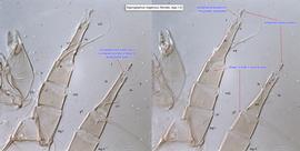  Fig. 11.  Saproglyphus neglectus  female legs I-II. 