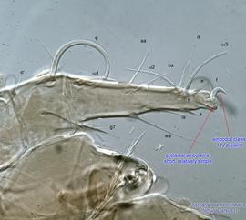  Fig. 12.  Aeroglyphus peregrinans  female leg I, lateral view. 