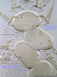  Fig. 12.  Anoetus  ex  Halictus ligatus  female coxal region. 