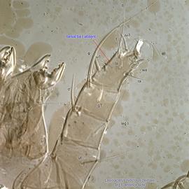  Fig. 13.  Lasioacarus nidicolus  female leg I, anterior side. 