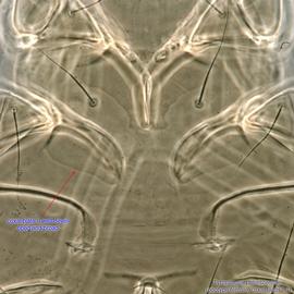  Fig. 13.  Tyrophagus putrescentiae  female idiosoma showing coxal fields I-II, ventral view. 