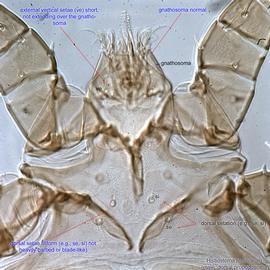  Fig. 14.  Histiostoma feroniarum  male propodosoma, dorsal view. 