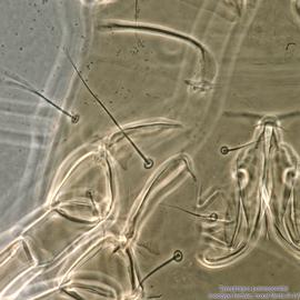  Fig. 14.  Tyrophagus putrescentiae  female idiosoma showing coxal fields III-IV, ventral view. 