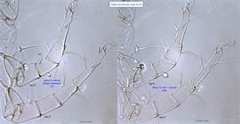  Fig. 14.  Vidia rubi  female legs III-IV. 