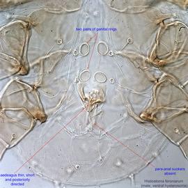  Fig. 15.  Histiostoma feroniarum  male hysterosoma, ventral view. 